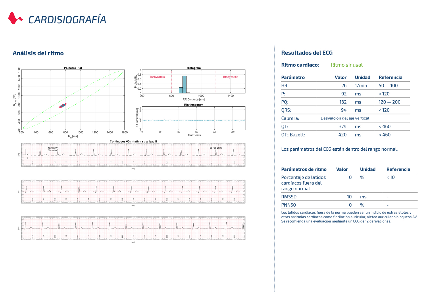 ECG y análisis del ritmo