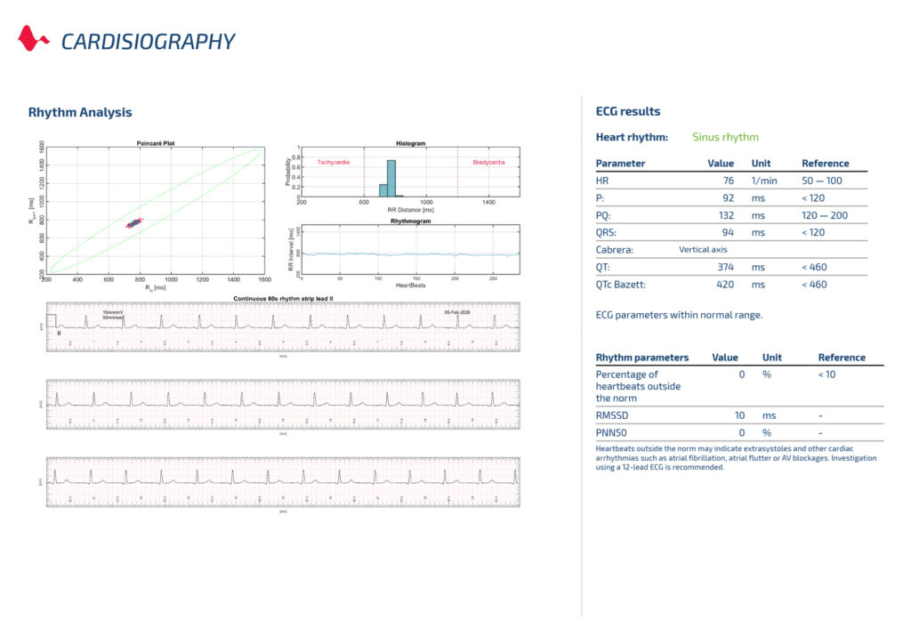 Procedure & Report - Cardisio GmbH
